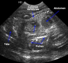 Echo_gestation