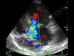 Echocardio_chien